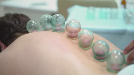 cupping therapy session