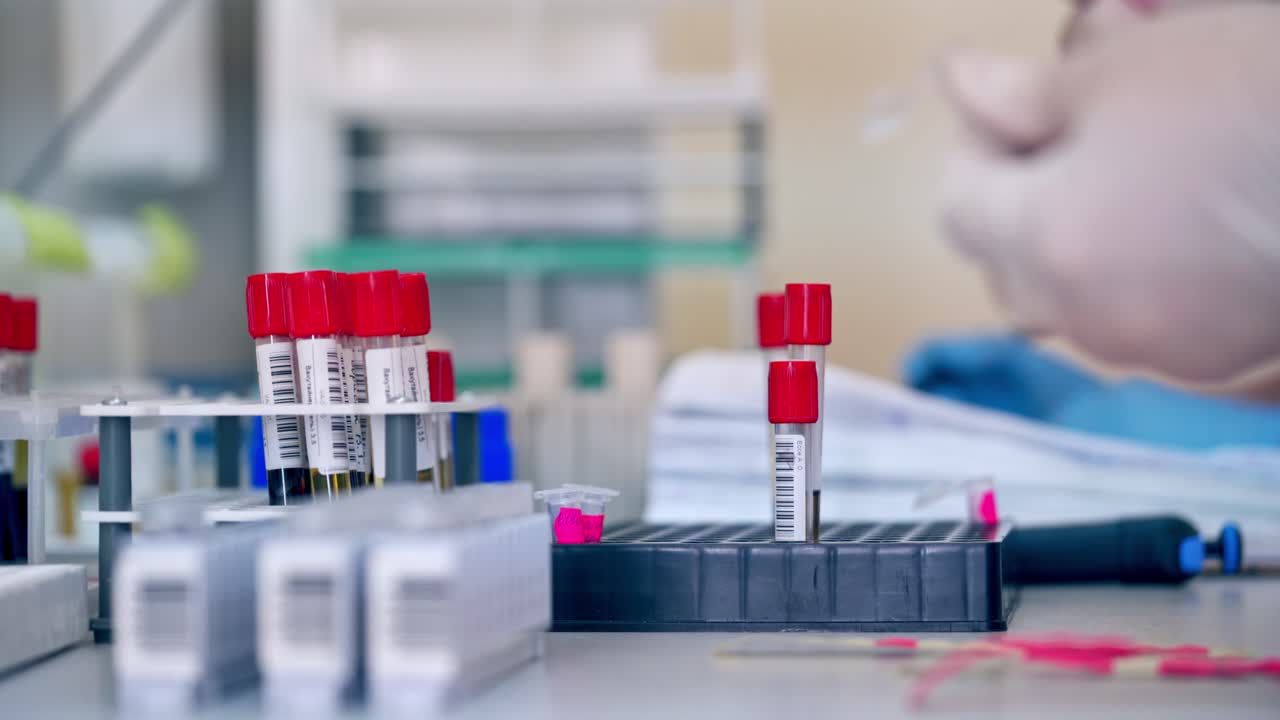 Blood samples on the table. Laboratory assistant working with vials in clinic. Test tubes with liquid on plastic supports. Close-up.