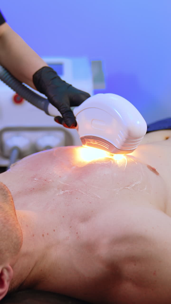 Hair is removed from Caucasian male's chest. Beautician performs procedure of elos epilation. Vertical video