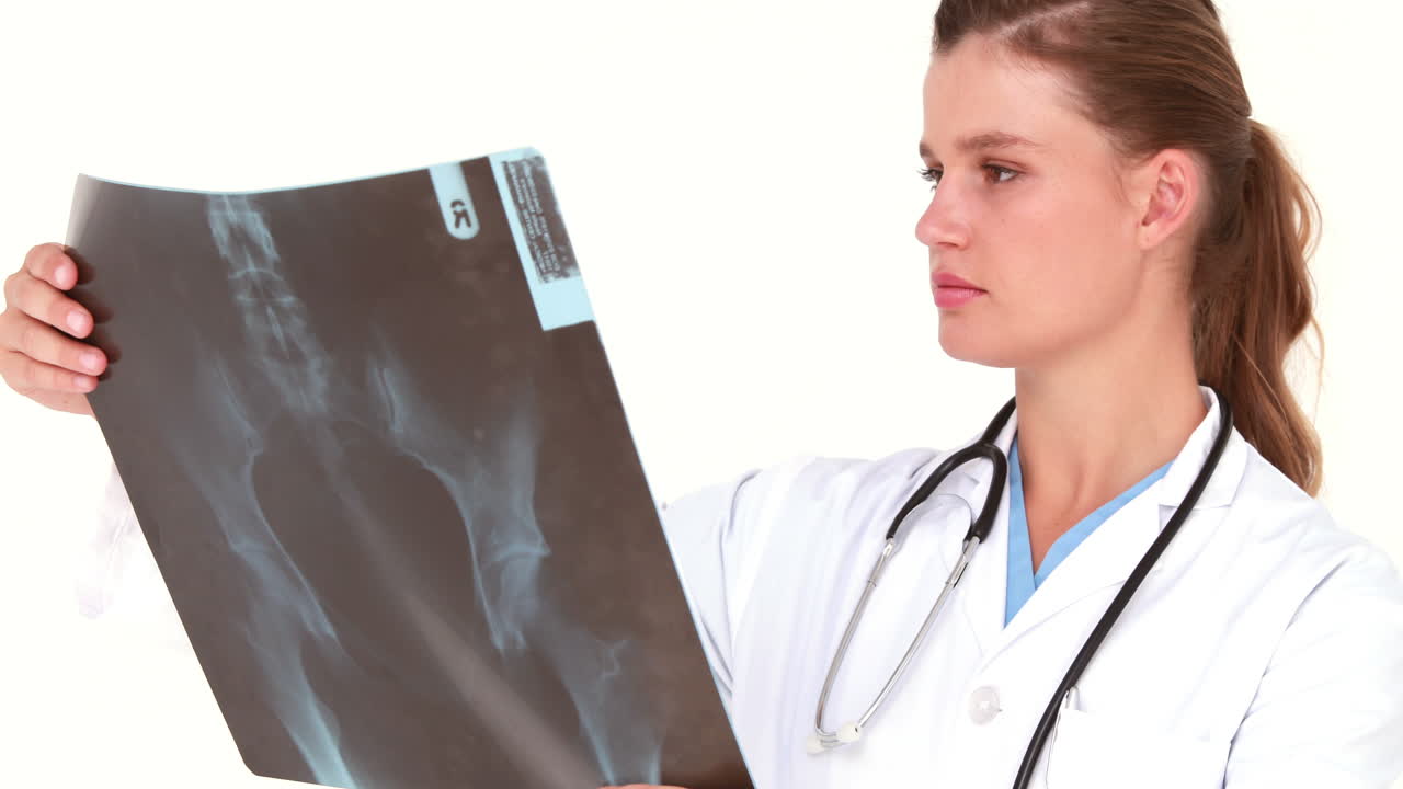 el doctor está contento con las radiografías.