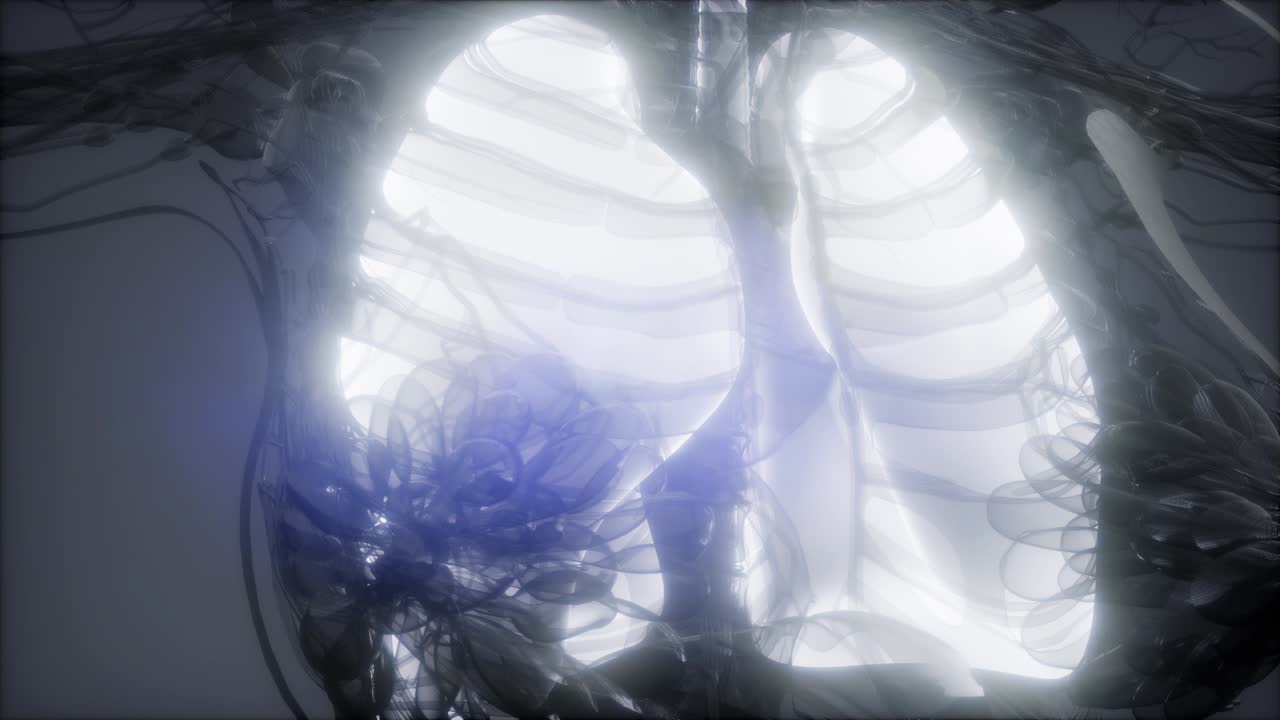 인간의 폐 방사선 검사