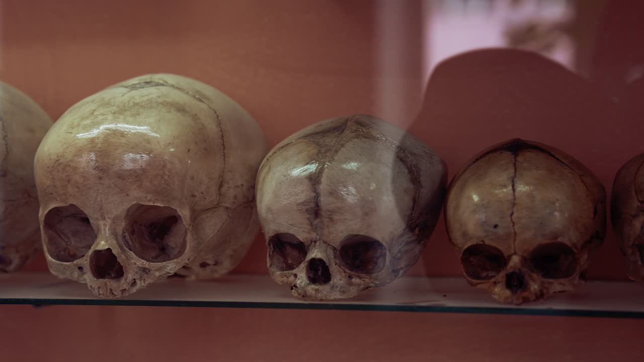 Ancient human skull in museum. Skulls raw shows human evolution at medical museum