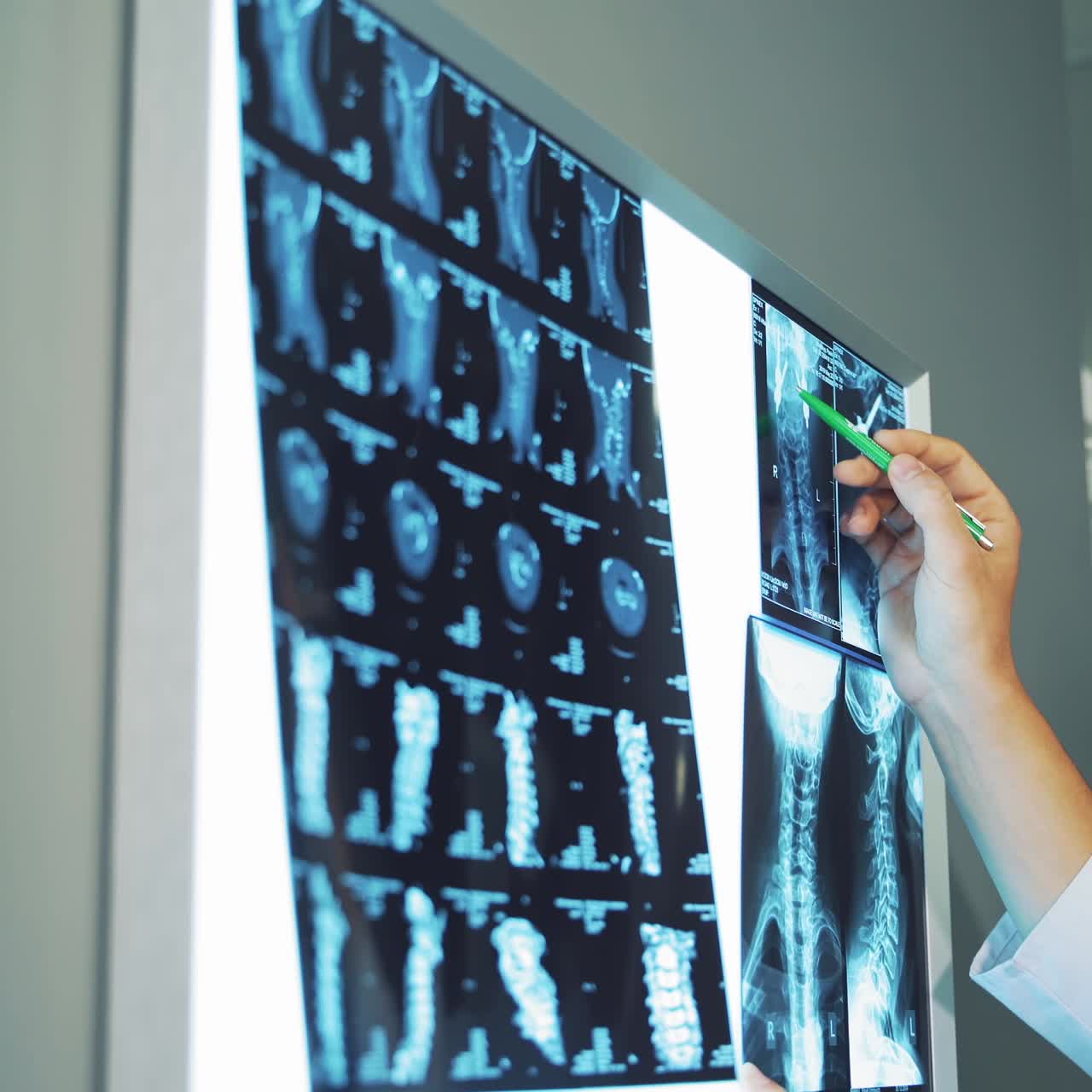 Medical doctors looking at x rays