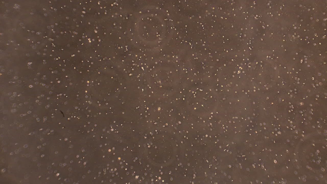 현미경 을 통해 볼 수 있는 인간 정자 세포 의  ⁇  아웃