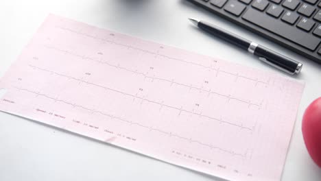 ecg recording on a desk