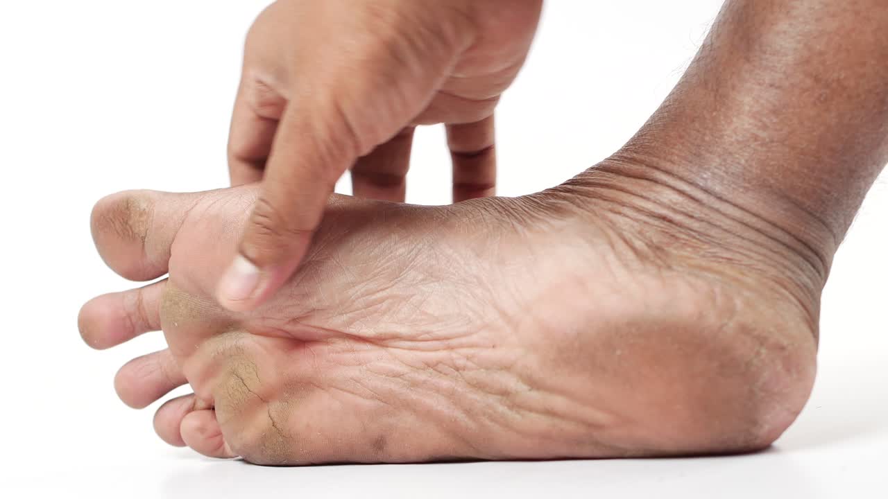 Primo piano dei piedi asciutti di giovani uomini isolati su bianco
