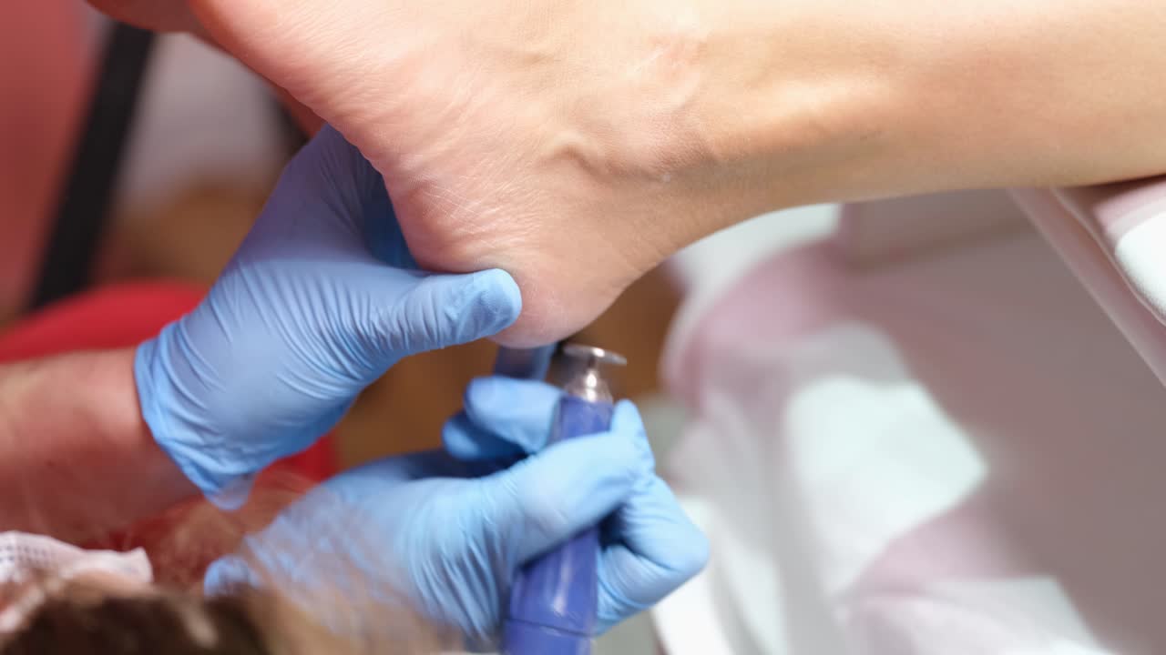 Pedicure treatment for foot health