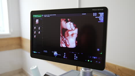 ultrasonido 3d de un feto
