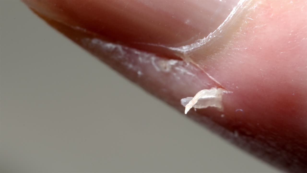 Close Up of Damaged Cuticle and Dry Finger Skin