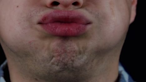 primer plano de la boca y los labios de una persona con posible enfermedad de la piel