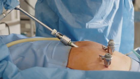 laparoscopic abdominal surgery