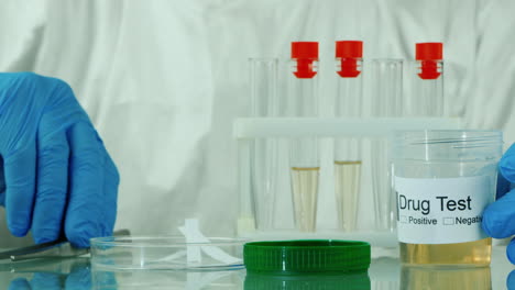 técnico de laboratorio hace una prueba de orina 8