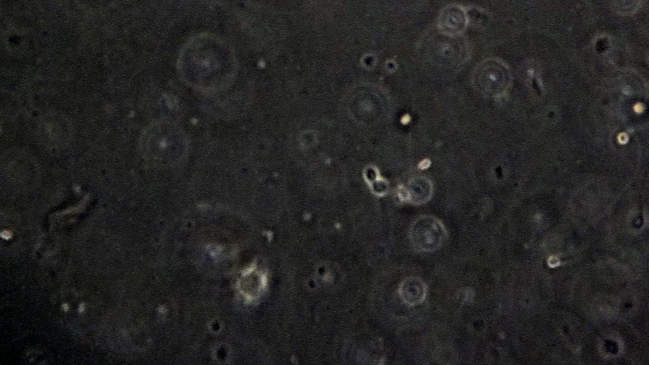 células espermáticas individuales vistas a través de un microscopio de contraste de fase