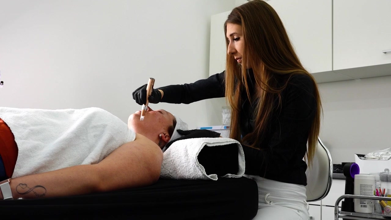 Realizando tratamento facial de microagulhamento num cliente em um spa.