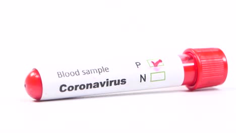 coronavirus blood sample test tube