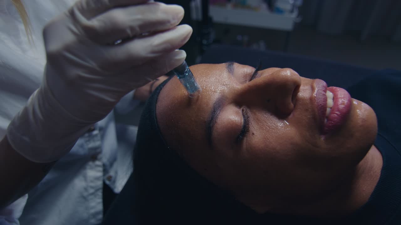 procedimiento de inyección facial