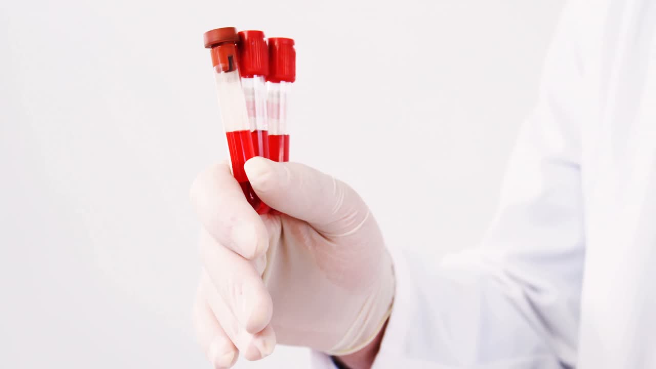Mid section of lab technician holding blood sample in tube