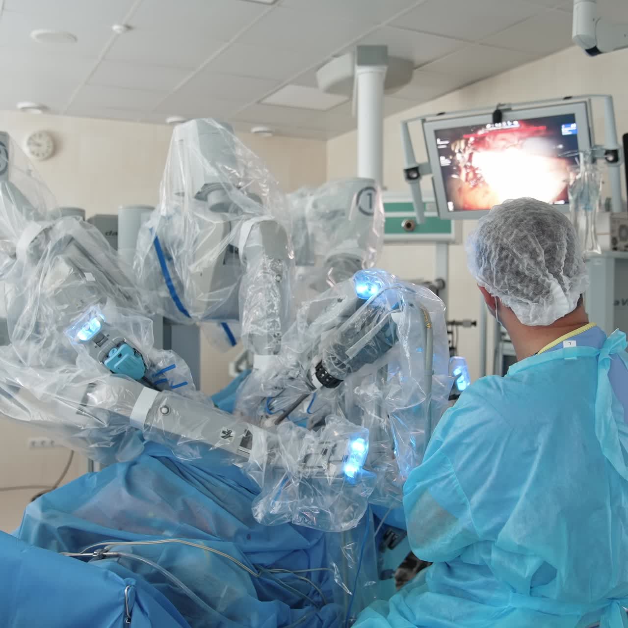Medical devices for neurosurgery. A group of doctors doing a surgical operation using a technique