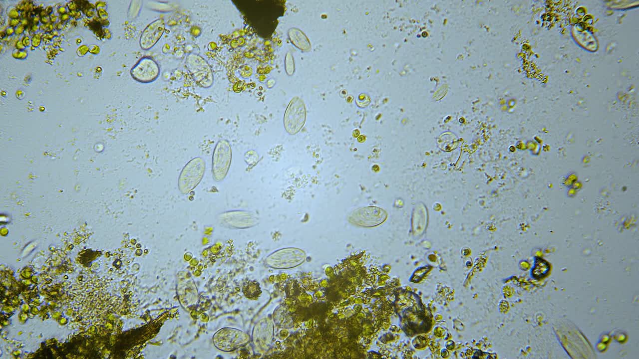 organismos unicelulares de paramecio en microscopio de campo claro