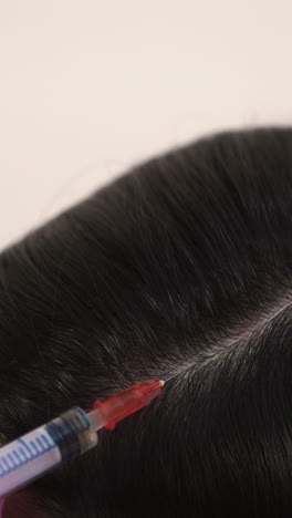 handsome woman receives an injection in the head. the concept of mesotherapy. thrust to strengthen the hair and their growth vertical video