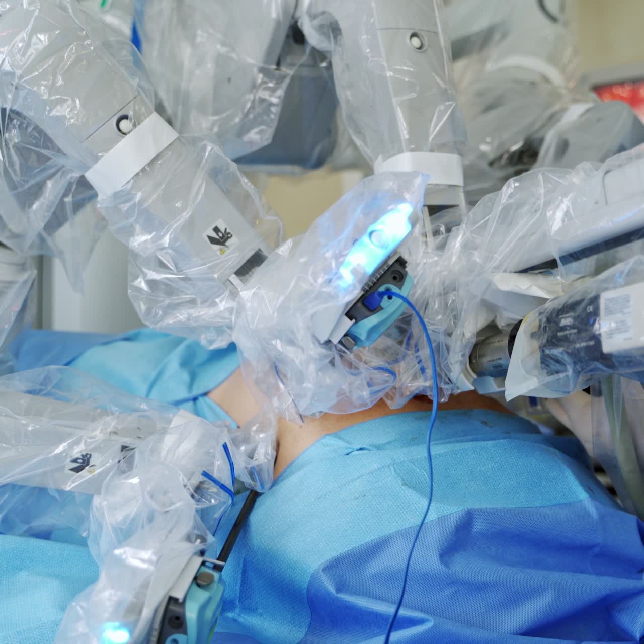 Modern medical equipment. Robotic machine works in the operating room. Minimally invasive robotic surgery. Close-up.