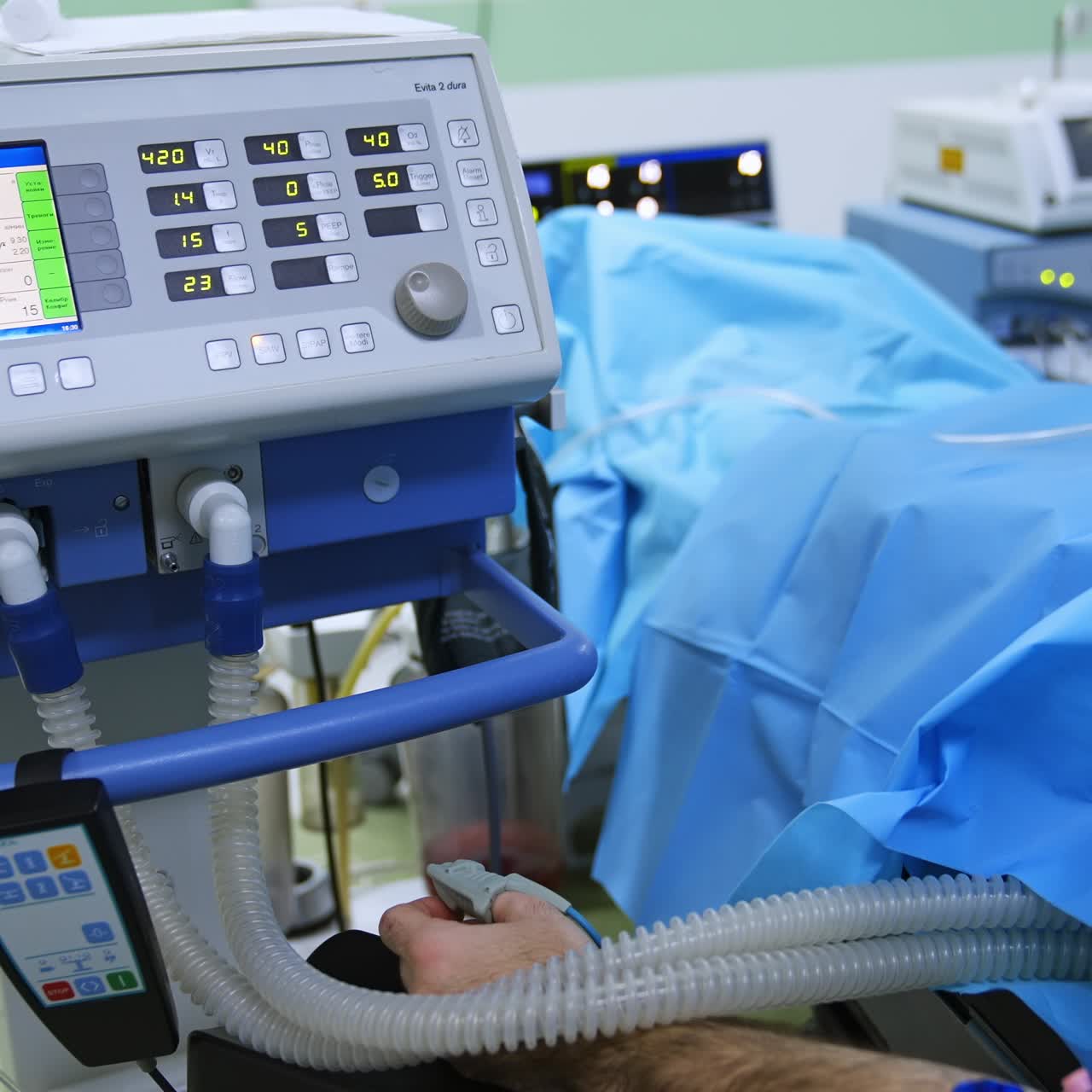 Patienten ligger på operationsbordet og er tilsluttet apparaterne. Udstyr i et moderne operationsrum.