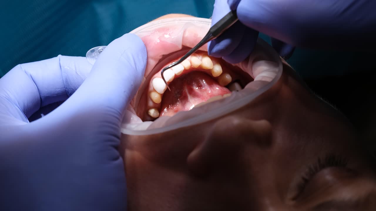 Dentist Performing Oral Examination on Patient