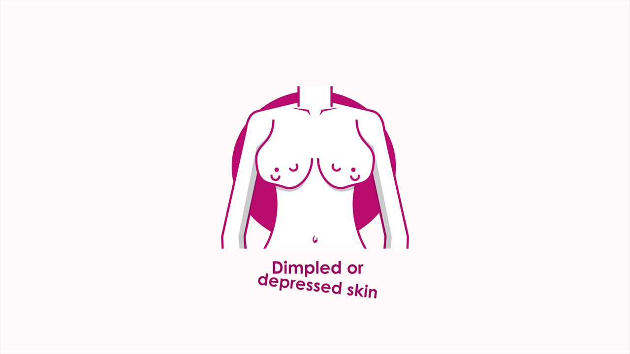 animación de concienciación sobre el cáncer de mama con el cuerpo de la niña en el frente