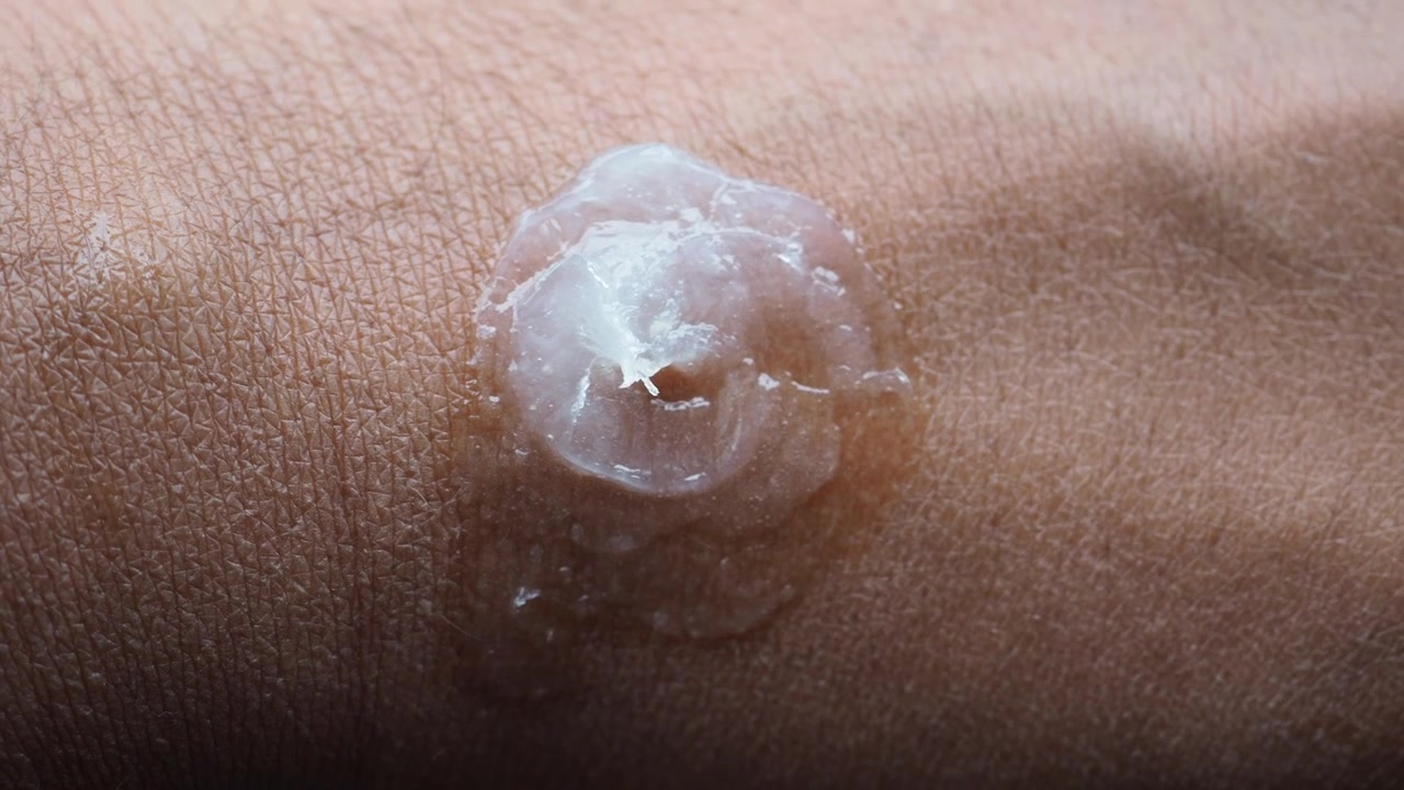 Primo piano di gel cosmetico trasparente con particelle bianche sulla pelle umana