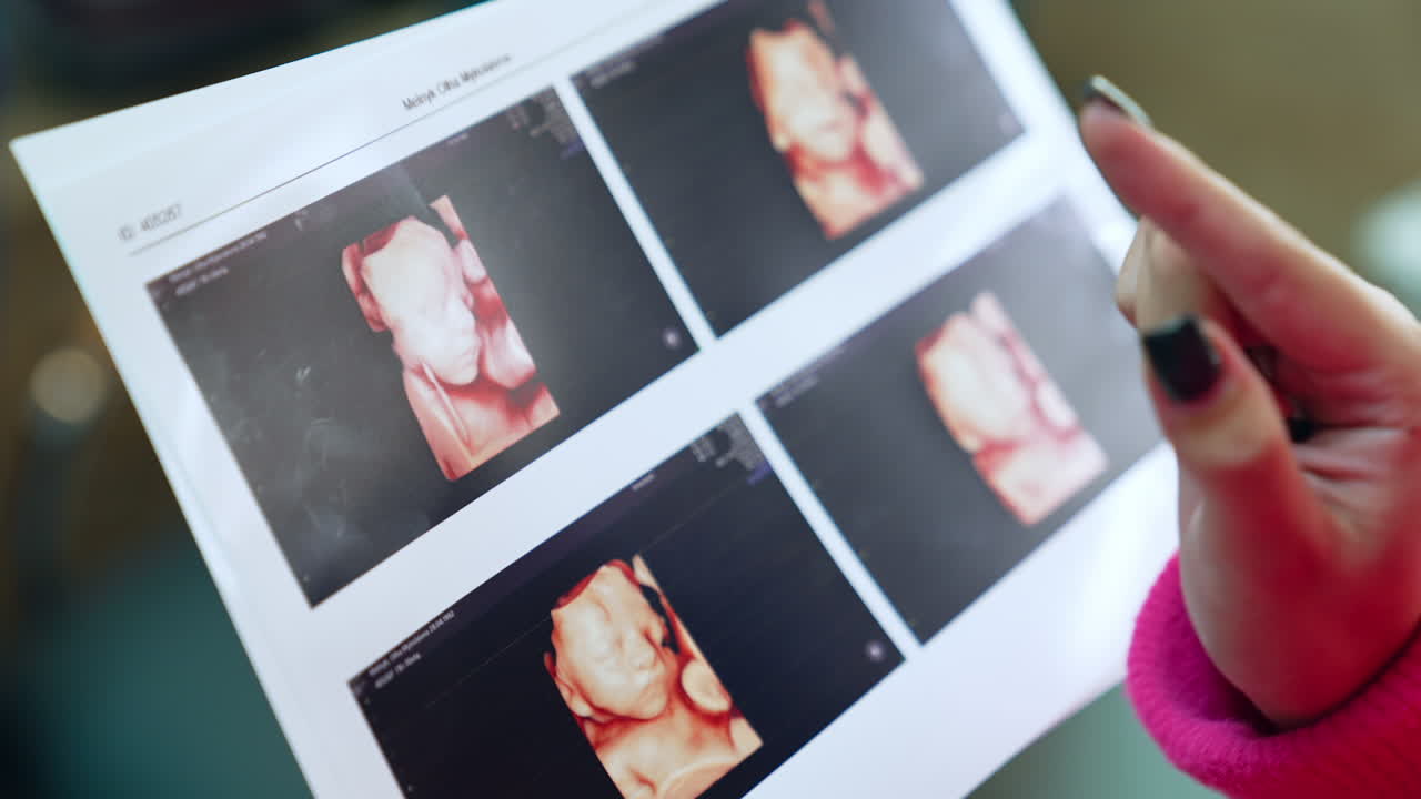 Female hand is touching the images of a baby on the ultrasound scans. Mom got the results of pregnancy ultrasonic examination. Close up.