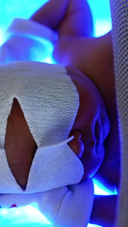 newborn baby in bandage on eyes lies with hands behind head on uv lamp. little child covered with blanket is treated from high level of bilirubin. top view close up. vertical video