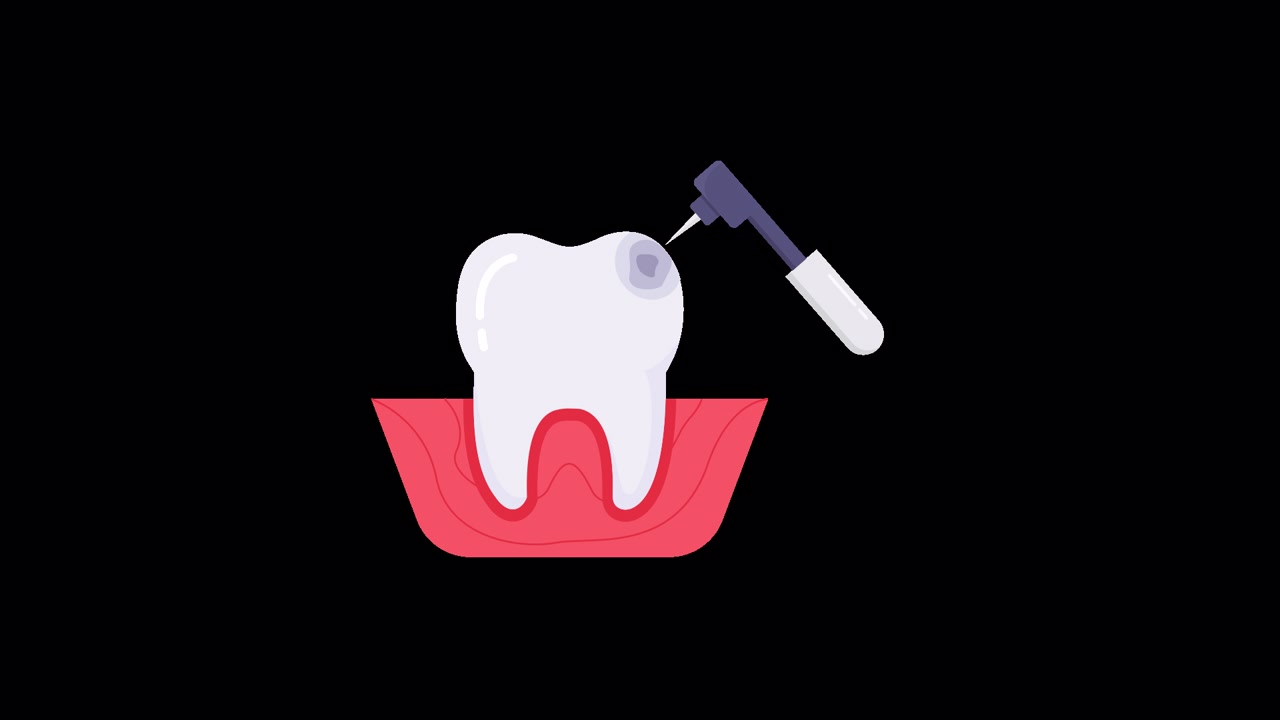 Animated Illustration of a Dental Drill Treating a Tooth Cavity