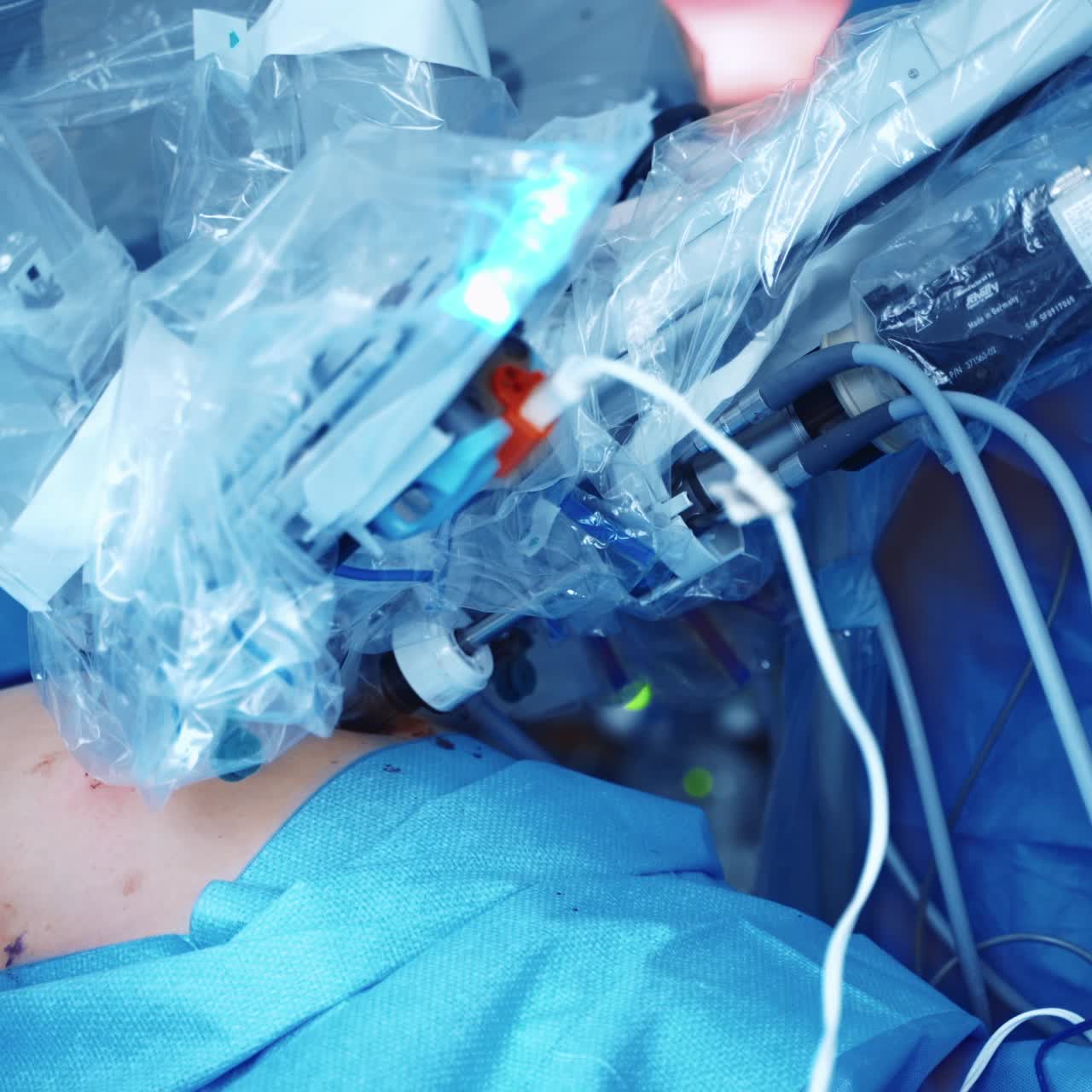 Operating room, medical surgical robot. Cancerous tumor removal surgery. Modern medical equipment. Minimally invasive robotic surgery