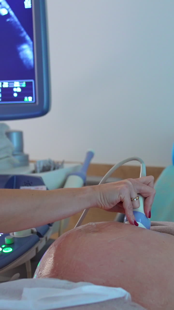 Woman at last months of pregnancy lies on the couch of a doctor. Obstetrician does the check up at ultrasound apparatus. Vertical video