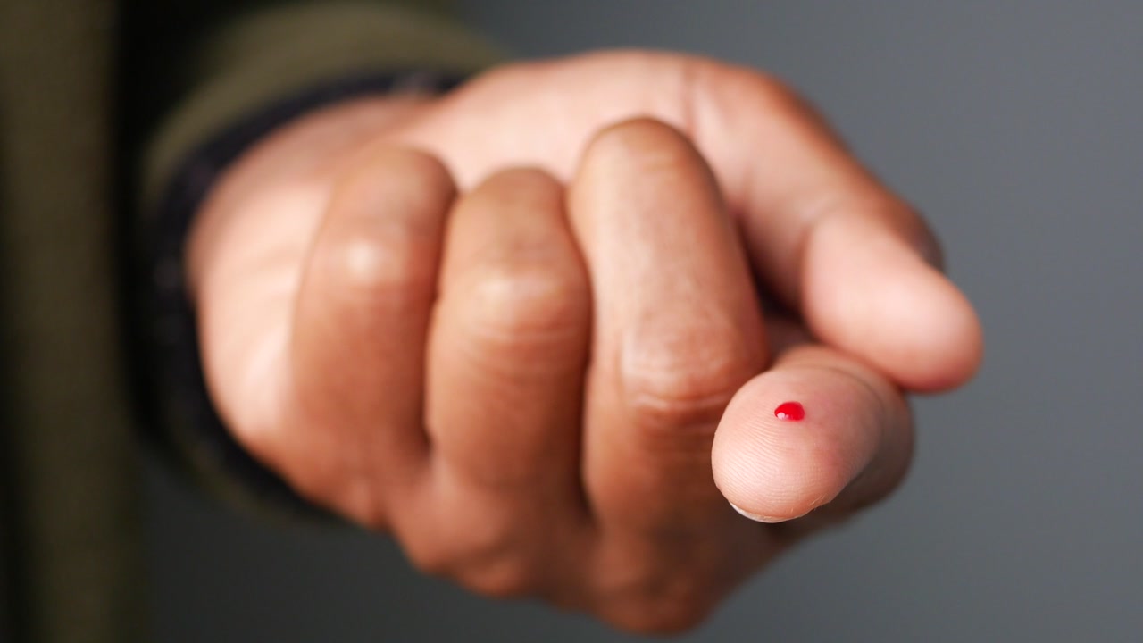 Close-up of a Small Blood Drop on a Human Finger