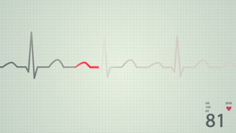 animation of a schematic diagram of normal sinus rhythm for a human heart seen on electrocardiograph screen. blue highlight on a bright background. perfect for any medical-related purposes.