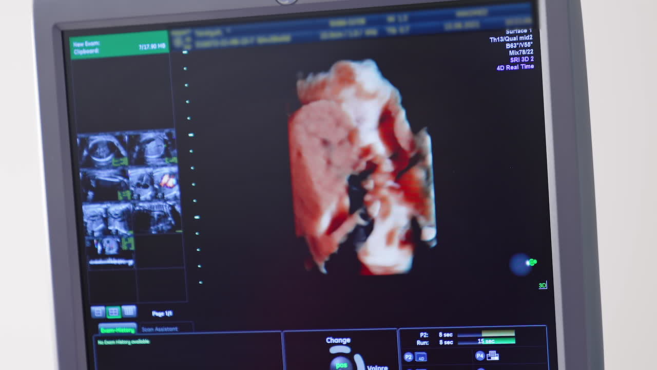 Ultrasound baby in a mother's womb. Ultrasound of pregnant woman. Scientific analysis