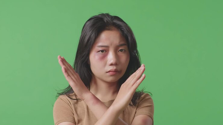Close Up Of Young Asian Woman With Bruise On Face Looks Into Camera Showing Hands Cross To Stop Violence In The Green Screen Background Studio
