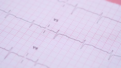 electrocardiogram (ecg) images