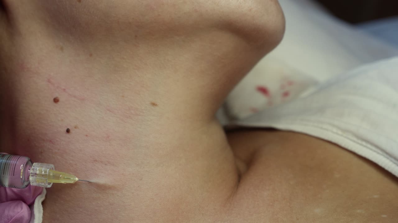 Medical Procedure on Neck