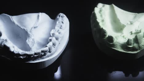 slide shot reveals restorative dentistry ceramic teeth mould castings