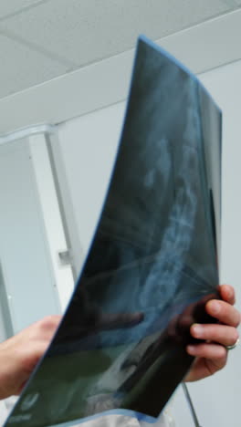 médico que examina las radiografías