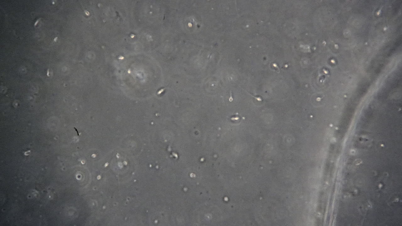 미세한 인간 정자 세포의 회전