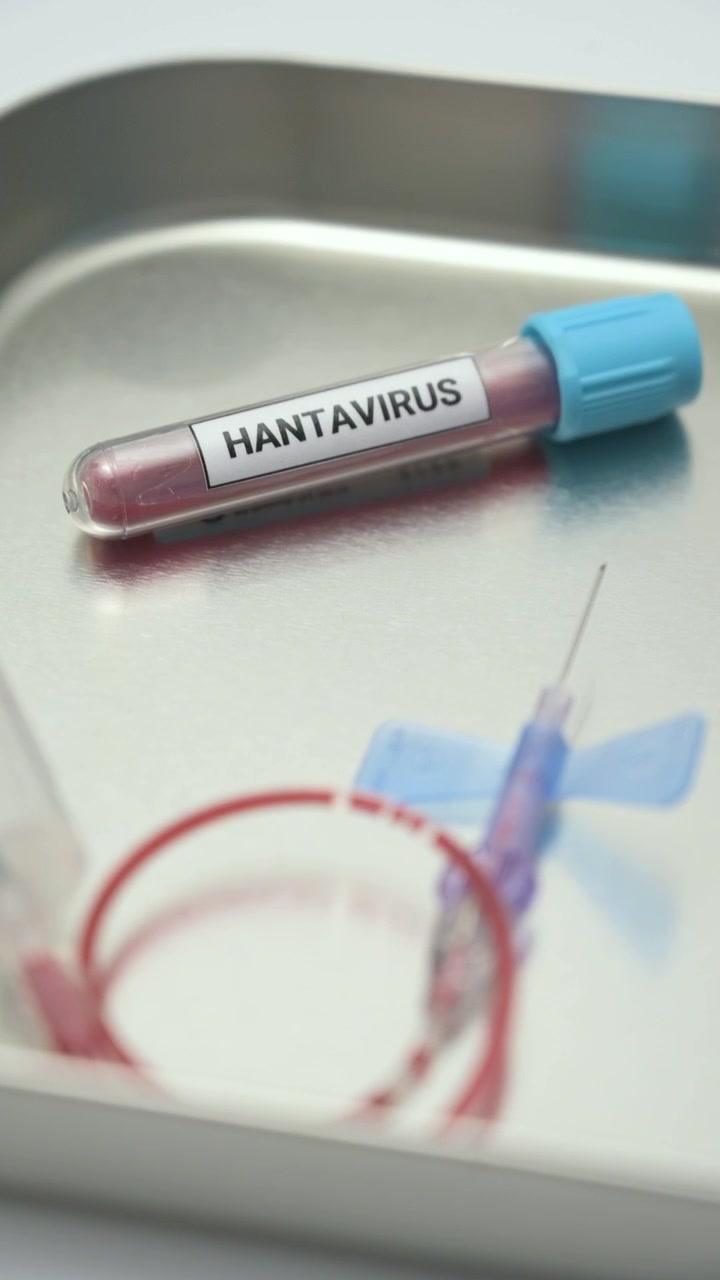 Scientist placing a Hantavirus blood sample on a stainless steel tray with a catheter nearby