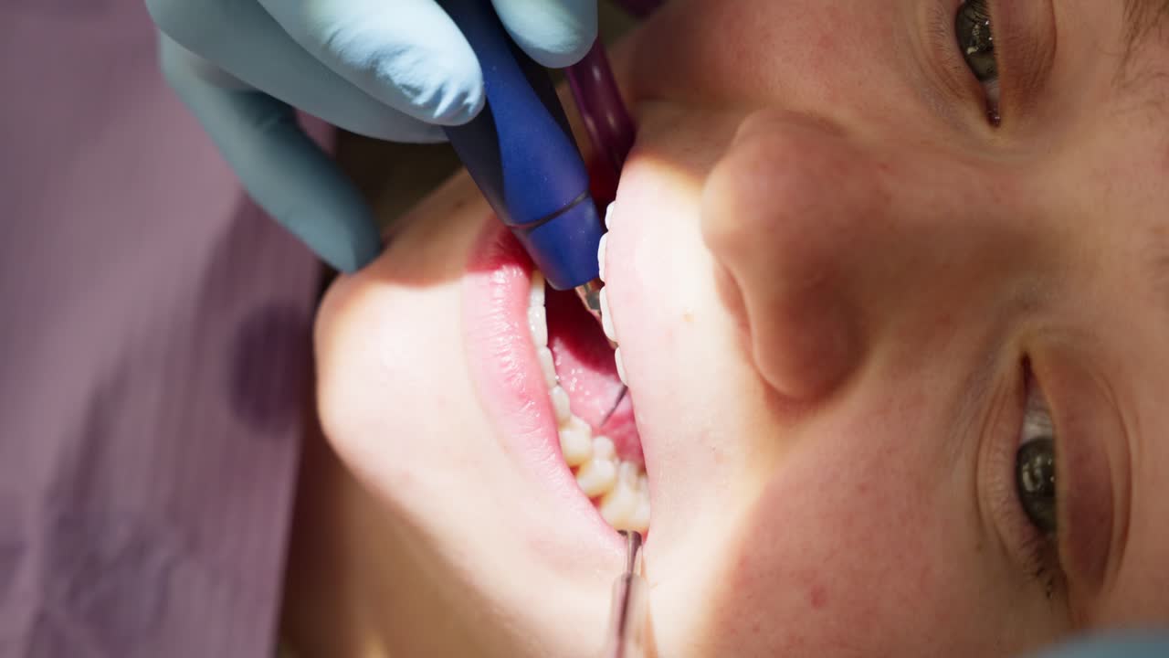 Close-Up of Patient Receiving Dental Cleaning and Examination
