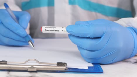 coronavirus blood sample test