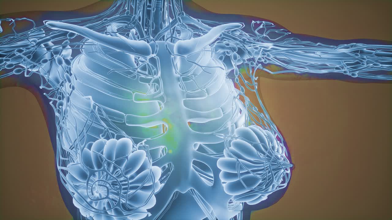 유방암 진단을 위한 매모그램 방사선 영상