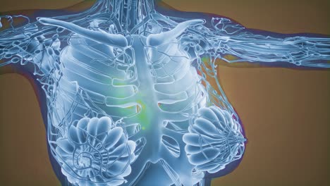 radiografía de mamografía para el diagnóstico del cáncer de mama