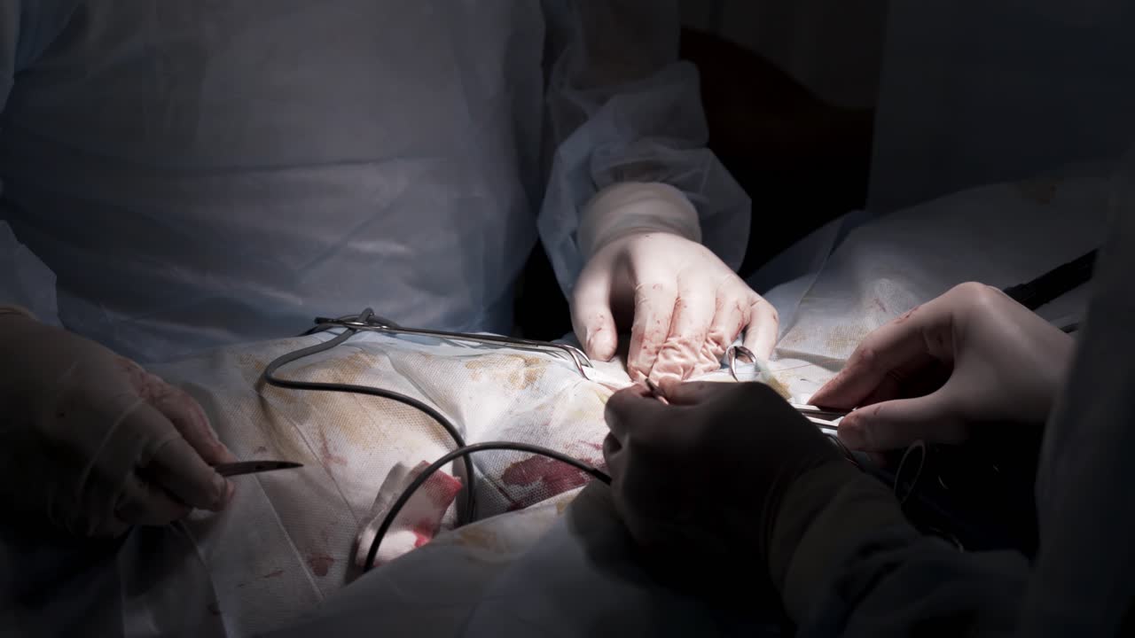 수술실에서 수술 절차