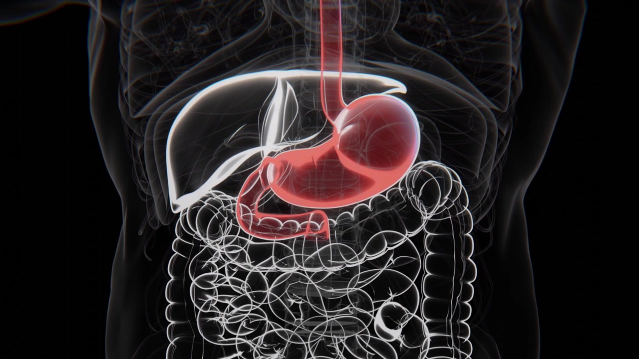 Acid reflux is a digestive condition in which stomach acid flows back into the esophagus, causing a burning sensation, chest discomfort, or irritation | Acid reflux indication Xray Video in 4K UHD